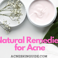Natural Remedies for Acne