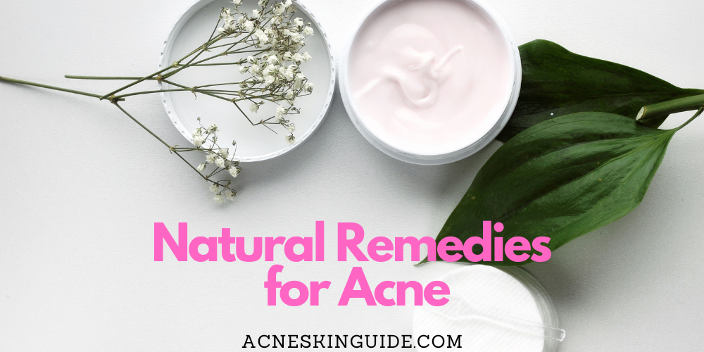 Natural Remedies for Acne