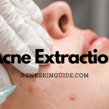 Acne Extraction