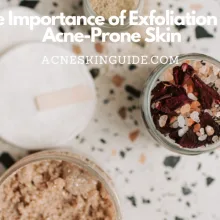 Exfoliation for Acne-Prone Skin