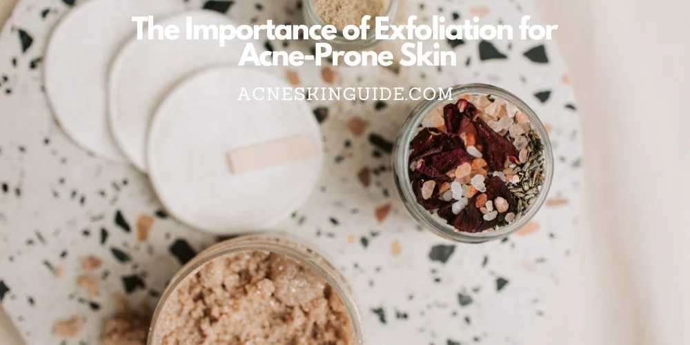 Exfoliation for Acne-Prone Skin