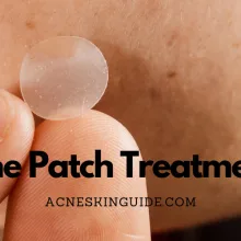 Hydrocolloid Acne Patch