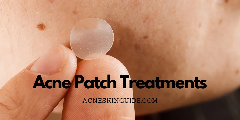Hydrocolloid Acne Patch