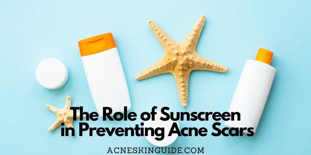 Sunscreen To Prevent Acne Scars