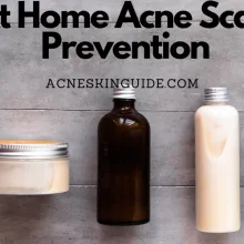 At Home Acne Scar Prevention