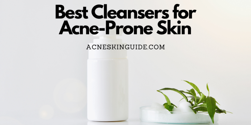 Best Cleanser Types for Acne-Prone Skin