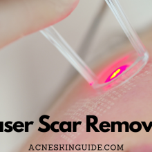 Laser Scar Removal