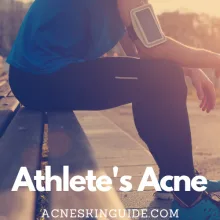 Athlete's Acne