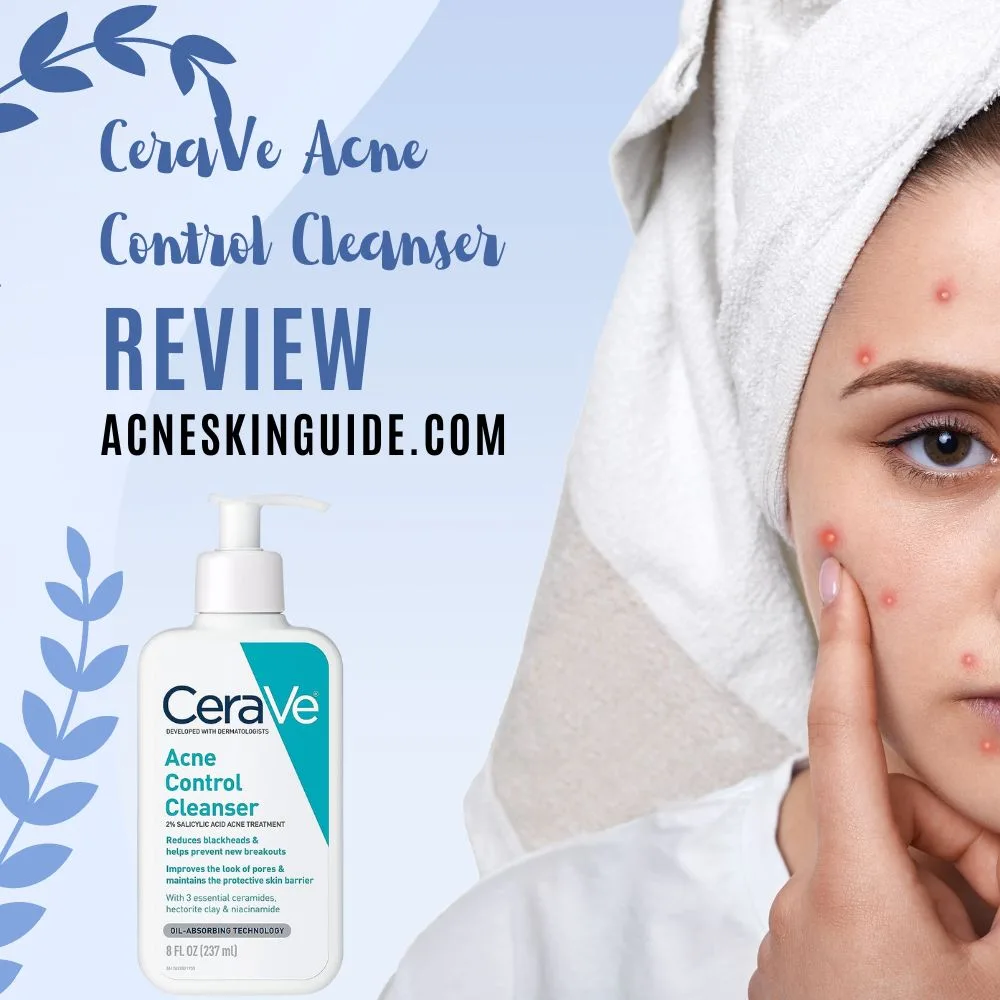 CeraVe Acne Control Cleanser Review